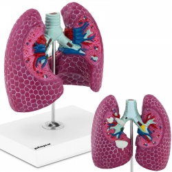 EAN 4062859971623 Model anatomiczny 3D płuca człowieka ze zmianami chorobowymi Hurtownia Zielona Góra